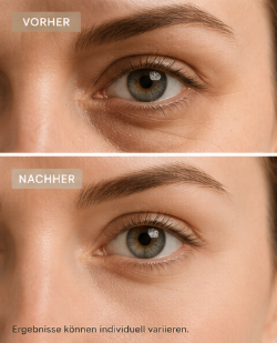 ReviveEye Massager